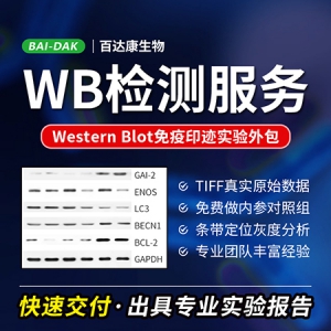 WB免疫印迹